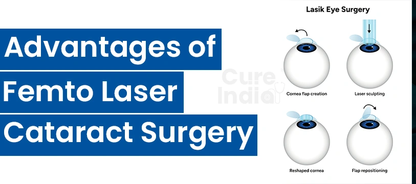 Advantages of Femto LASIK Eye Surgery